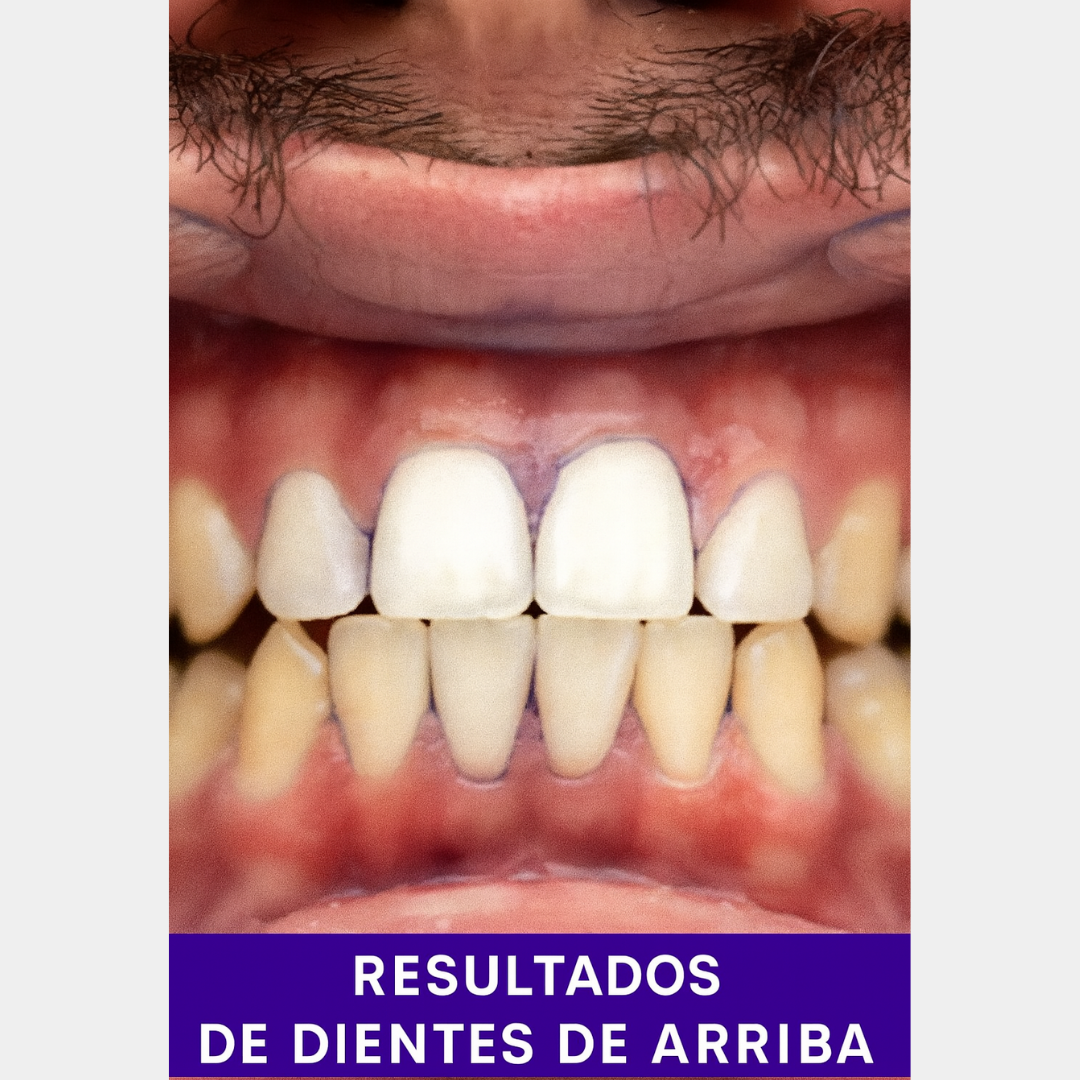 Tiras Blanqueadoras V34