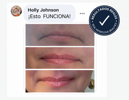 Rellenador Labial Natural Efecto Volumen