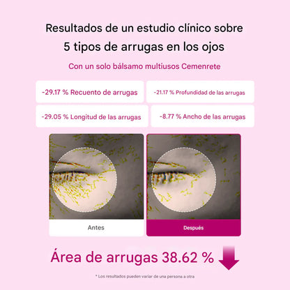 Bálsamo antiarrugas GLUMI