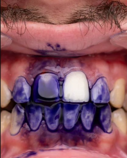 Blanqueador V34 Glumi