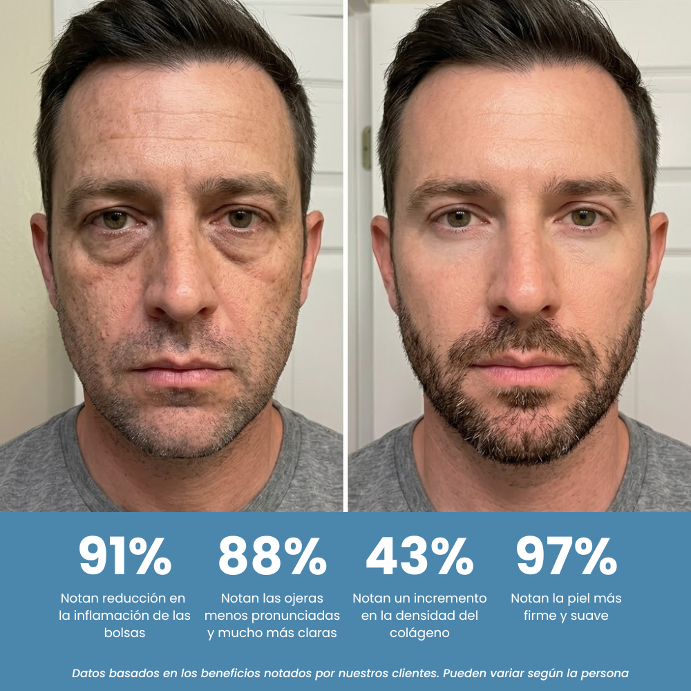 Gafas Anti Bolsas y Ojeras