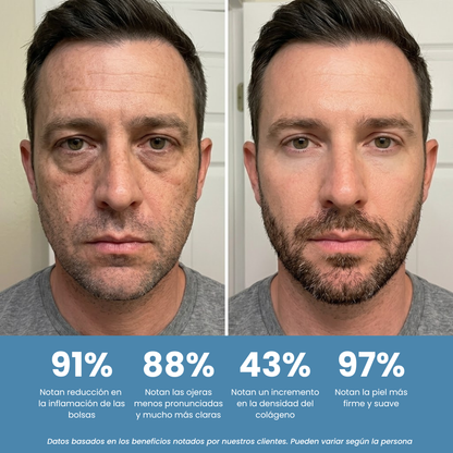 Gafas Anti Bolsas y Ojeras