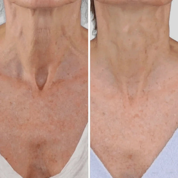 Nancy M., 59 años