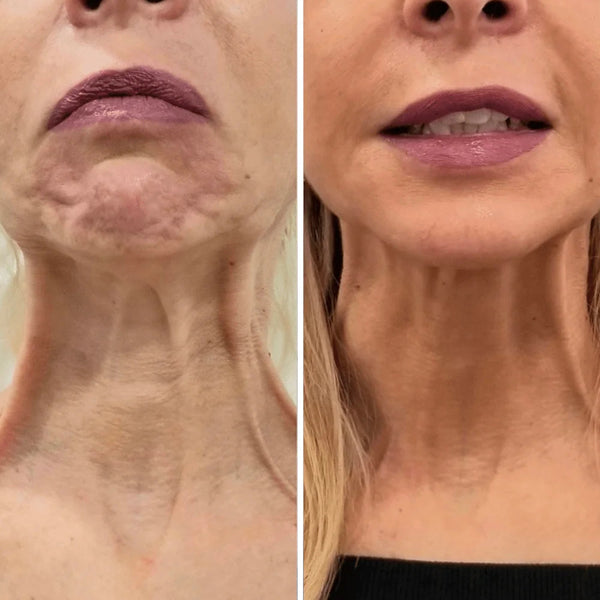 Anna Z., 62 años