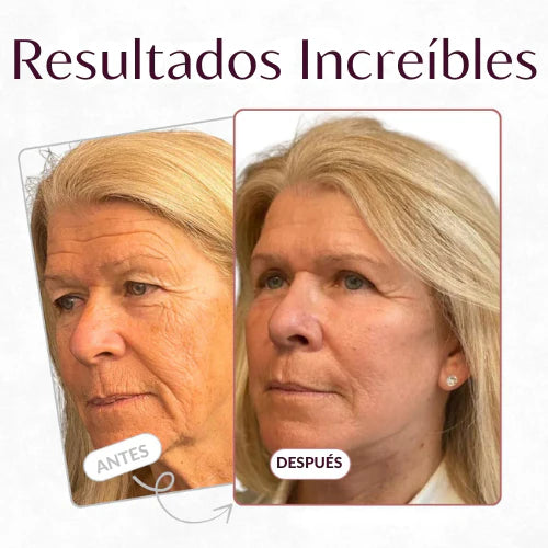 Bálsamo antiarrugas GLUMI