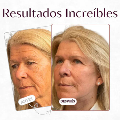 Bálsamo antiarrugas GLUMI